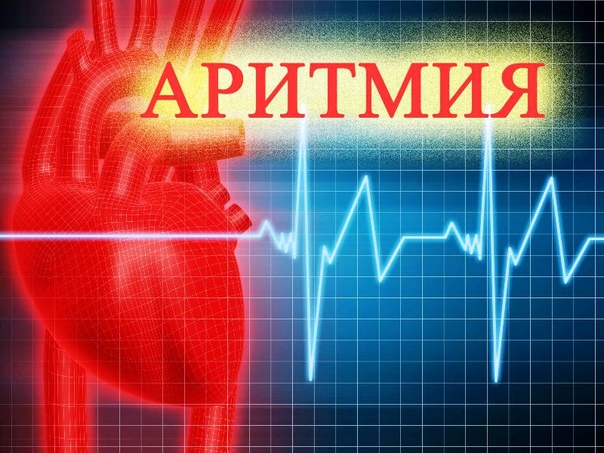 АРИТМИЯ--БОЛЕЗНЬ СЕРДЦА,А ЛЕЧИТЬ НУЖНО НЕРВЫ Признаки аритмии - перебои, замирание сердца, резкое хаотическое сердцебиение. Многие виды аритмии не представляют угрозы для человека, но